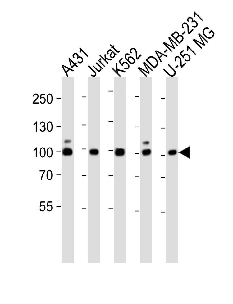 Anti-ZNF175 (N-term) Antibody