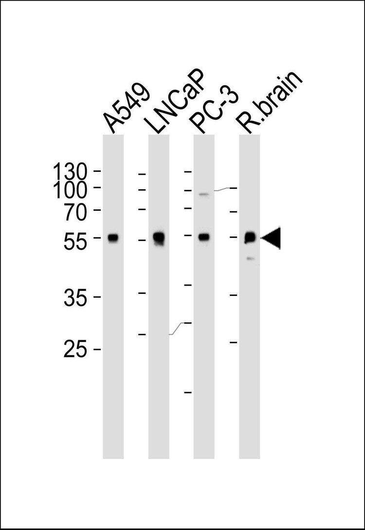 Anti-ADRA1D (N-term) Antibody