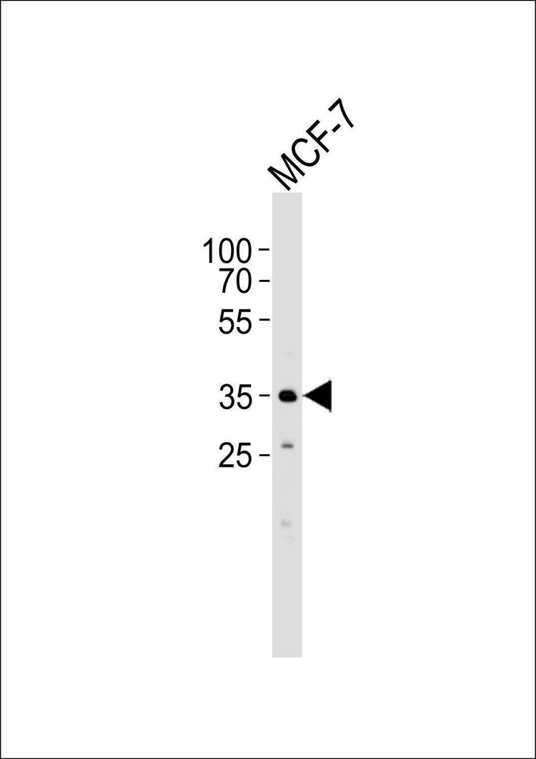 Anti-FBXL17 Isoform 2 (C-term) Antibody