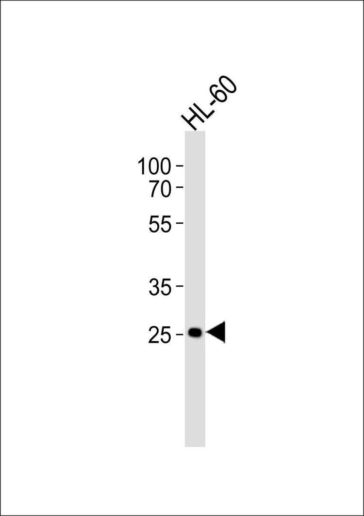 Anti-FCGR3B (N-term) Antibody