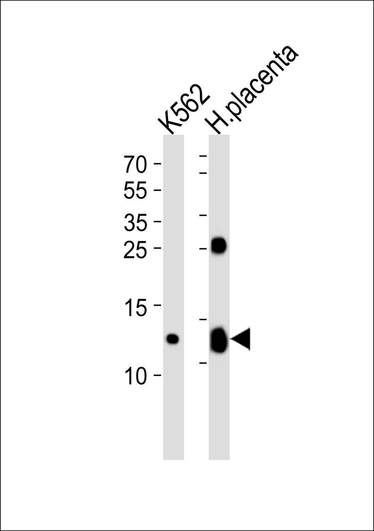 Anti-HBG2 (C-term) Antibody