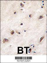 Anti-GDF1 (N-term) Antibody