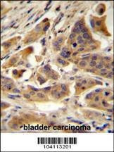 Anti-RBCK1 (UBCE7IP3) (N-term) Antibody