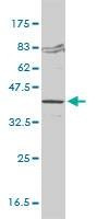 Anti-FVT1 Antibody