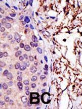 Anti-UBE2L3 (N-term) Antibody