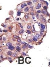 Anti-UBE2L3 (C-term) Antibody