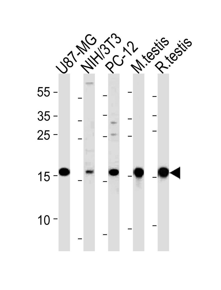 Anti-UBE2L3 (C-term) Antibody