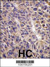 Anti-UBE2L6 (N-term) Antibody