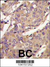 Anti-UBE2L6 (C-term) Antibody