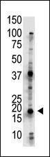 Anti-UBE2G2 (N-term) Antibody