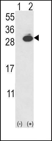 Anti-UCHL1 (N-term) Antibody