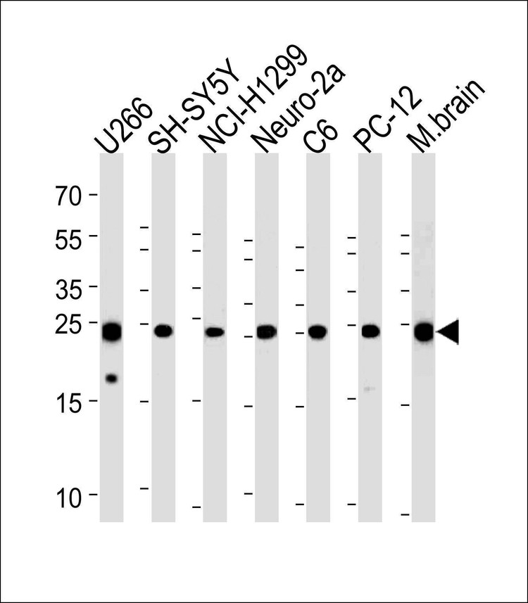 Anti-UCHL1 (C-term) Antibody