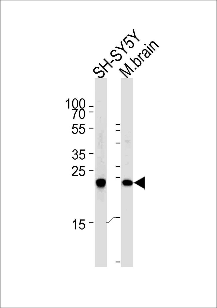 Anti-UCHL1 (C-term) Antibody