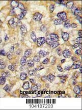 Anti-UCHL3 (C-term) Antibody