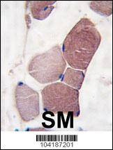 Anti-UCHL3 (C-term) Antibody