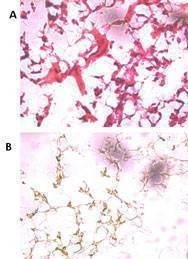 Anti-UCH37 (UCHL5) (N-term) Antibody