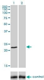 Anti-FXN Antibody