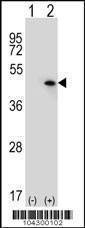 Anti-USP12/USP46 (C-term) Antibody
