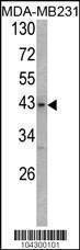 Anti-USP12/USP46 (C-term) Antibody