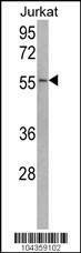 Anti-USP22 (C-term) Antibody