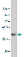 Anti-FYN Antibody
