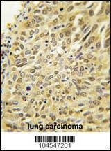 Anti-Dsk2 (N-term) Antibody