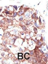 Anti-Ubiquilin1 (PLIC1) (N-term) Antibody