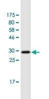 Anti-FZD2 Antibody