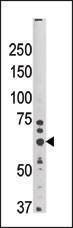 Anti-SYVN1 (HRD1) (N-term) Antibody