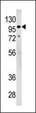 Anti-LLGL2 (N-term) Antibody