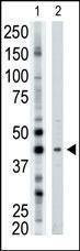 Anti-ART3 (N-term) Antibody