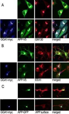 Anti-GGA1 (N-term) Antibody