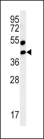Anti-RAGE (AGER) (N-term) Antibody