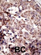 Anti-RAGE (AGER) (N-term) Antibody