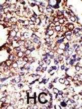Anti-GCNT1 (Center) Antibody