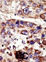 Anti-ZMPSTE24 (C-term) Antibody