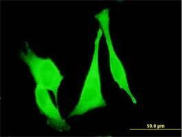 Anti-FZD3 Antibody
