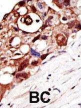 Anti-GPI8 (N-term) Antibody