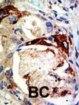 Anti-Mouse Myb Sumoylation Site Antibody