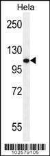 Anti-Androgen Receptor (ANDR) Antibody