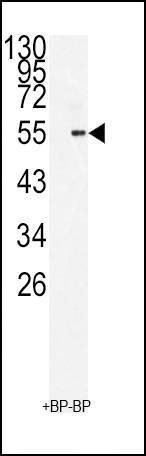 Anti-BMI1 (C-term) Antibody