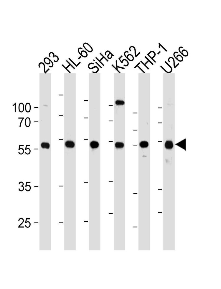 Anti-YY1 (N-term) Antibody