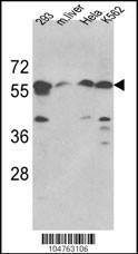 Anti-SPTLC1 (N-term) Antibody