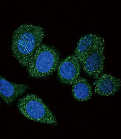 Anti-ACSL4 (FACL4) (Center) Antibody
