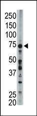 Anti-FACL6 (Center) Antibody