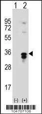 Anti-PPT1 (C-term) Antibody