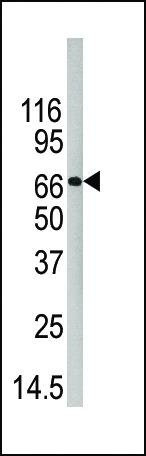Anti-PAD4 (C-term) Antibody