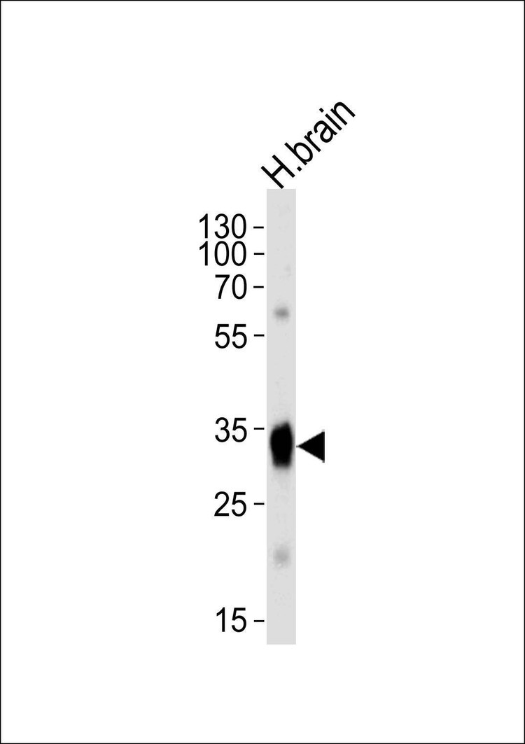 Anti-SULT4A1a/b (N-term) Antibody