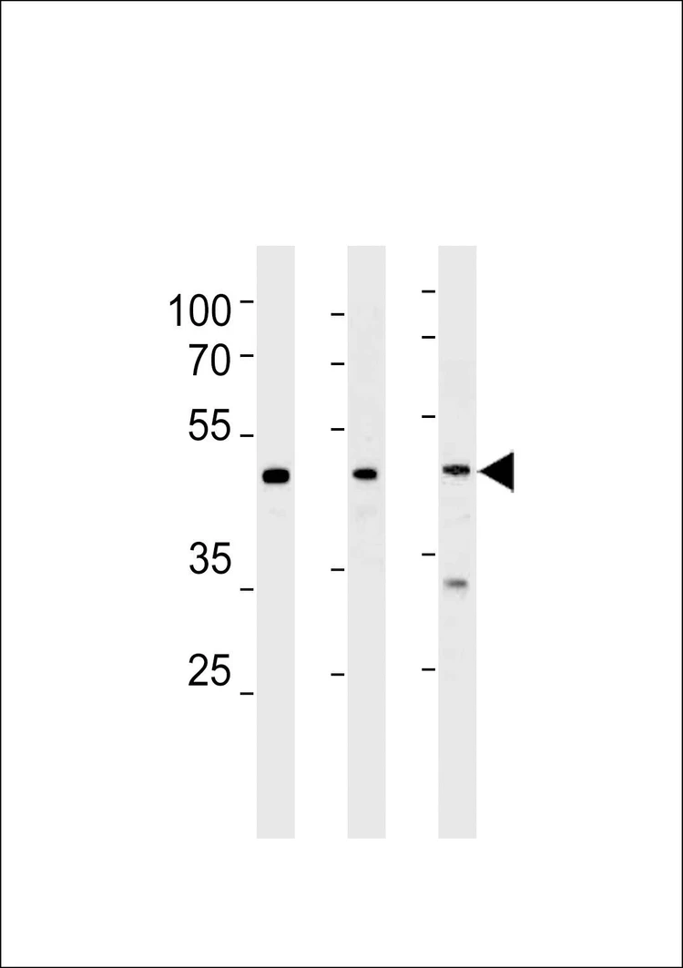 Anti-DAX1 (NR0B1) (N-term) Antibody