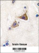Anti-Mouse Junctophilin 3 (Center) Antibody